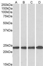 SOD2 (MnSOD) Antibody in Western Blot (WB)