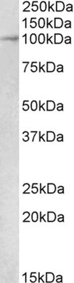 MALT1 Antibody in Western Blot (WB)