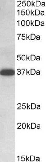 IDH3A Antibody in Western Blot (WB)