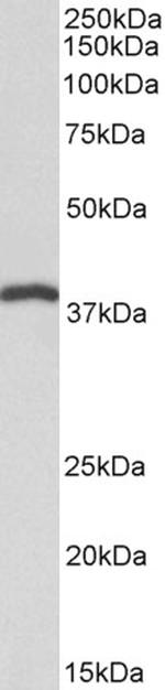 IDH3B Antibody in Western Blot (WB)
