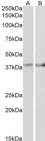 IDH3B Antibody in Western Blot (WB)