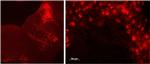 TPH2 Antibody in Immunohistochemistry (IHC)