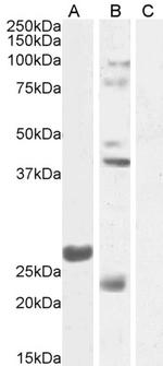 FGF23 Antibody in Western Blot (WB)