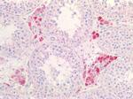 TNFR2 Antibody in Immunohistochemistry (Paraffin) (IHC (P))