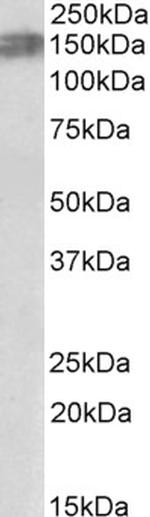 ALK Antibody in Western Blot (WB)