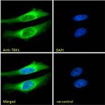 TBK1 Antibody in Immunocytochemistry (ICC/IF)