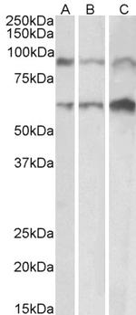 ADAM12 Antibody in Western Blot (WB)