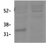 HSD11B1 Antibody in Western Blot (WB)