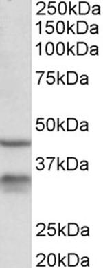 HSD11B1 Antibody in Western Blot (WB)