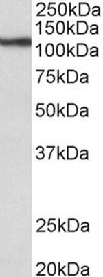 Thyroid Peroxidase Antibody in Western Blot (WB)