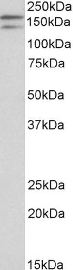 DUOX1 Antibody in Western Blot (WB)