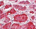 ACACB Antibody in Immunohistochemistry (Paraffin) (IHC (P))