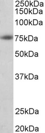 beta Amyloid Antibody in Western Blot (WB)