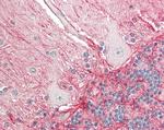 beta Amyloid Antibody in Immunohistochemistry (Paraffin) (IHC (P))