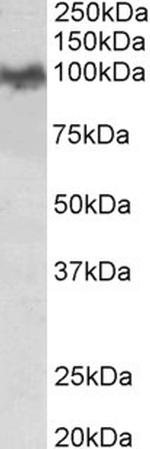 beta Amyloid Antibody in Western Blot (WB)