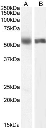 CYP1A2 Antibody in Western Blot (WB)