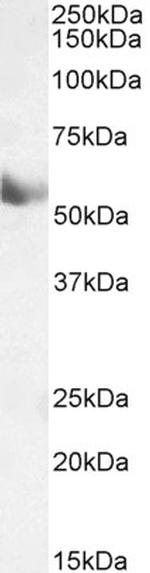 CYP1A1 Antibody in Western Blot (WB)