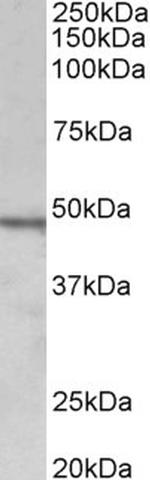 Chitotriosidase Antibody in Western Blot (WB)