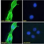 NMDAR2A Antibody in Immunocytochemistry (ICC/IF)