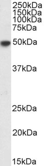 IRF4 Antibody in Western Blot (WB)