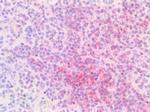 IRF4 Antibody in Immunohistochemistry (Paraffin) (IHC (P))