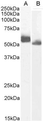 IRF4 Antibody in Western Blot (WB)