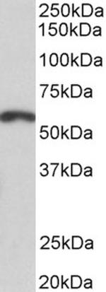 PAX3 Antibody in Western Blot (WB)