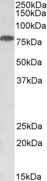 IKK alpha Antibody in Western Blot (WB)