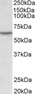 LCK Antibody in Western Blot (WB)