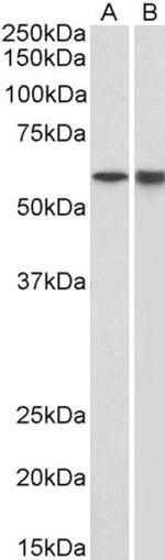 LCK Antibody in Western Blot (WB)