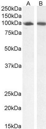 STAT5 alpha Antibody in Western Blot (WB)