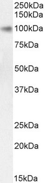 STAT5 alpha Antibody in Western Blot (WB)