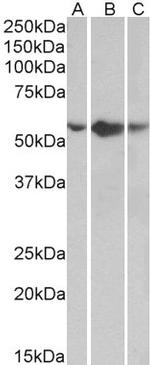 TNFR1 Antibody in Western Blot (WB)