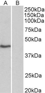 TBP Antibody in Western Blot (WB)