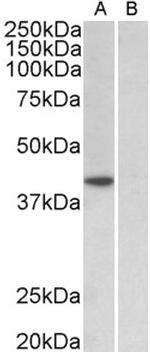 TBP Antibody in Western Blot (WB)