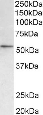 HDAC1 Antibody in Western Blot (WB)