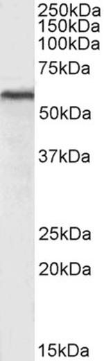 HDAC2 Antibody in Western Blot (WB)