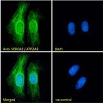 SERCA2 ATPase Antibody in Immunocytochemistry (ICC/IF)