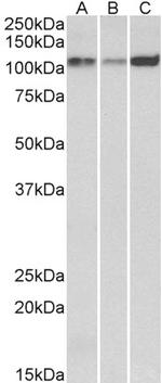 SERCA2 ATPase Antibody in Western Blot (WB)