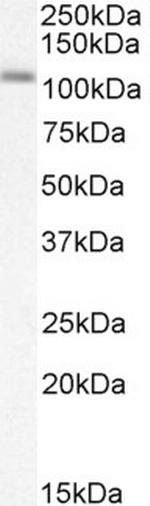 SERCA2 ATPase Antibody in Western Blot (WB)