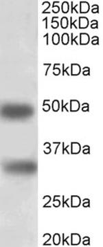 GEM Antibody in Western Blot (WB)