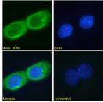 USP6 Antibody in Immunocytochemistry (ICC/IF)