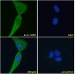 USP6 Antibody in Immunocytochemistry (ICC/IF)