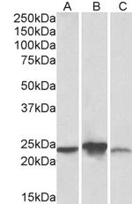 ABHEB Antibody in Western Blot (WB)