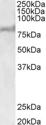 ABCD2 Antibody in Western Blot (WB)