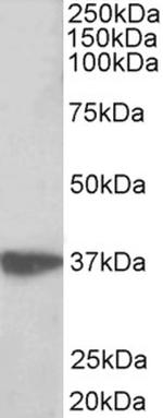 EMAP II Antibody in Western Blot (WB)