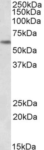 PLK1 Antibody in Western Blot (WB)