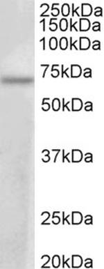 PRMT3 Antibody in Western Blot (WB)