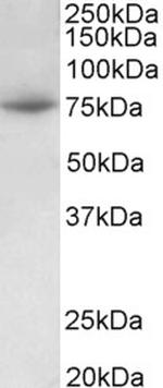 PRMT7 Antibody in Western Blot (WB)