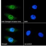 Estrogen Receptor beta Antibody in Immunocytochemistry (ICC/IF)